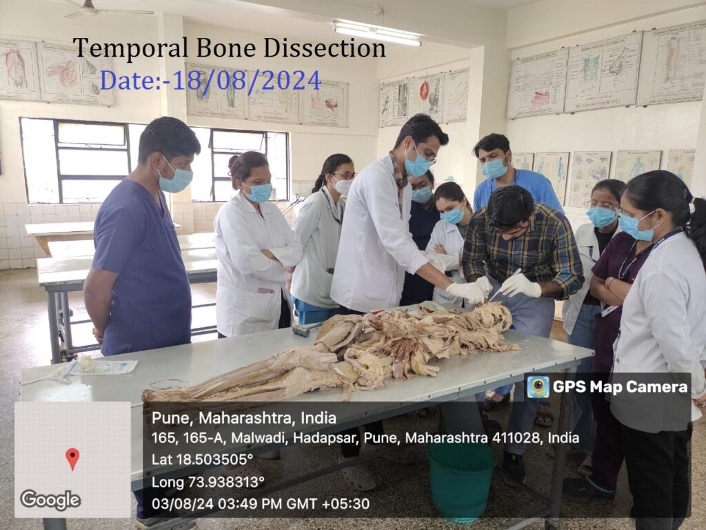 Temporal Bone Dissection -18-08-2024